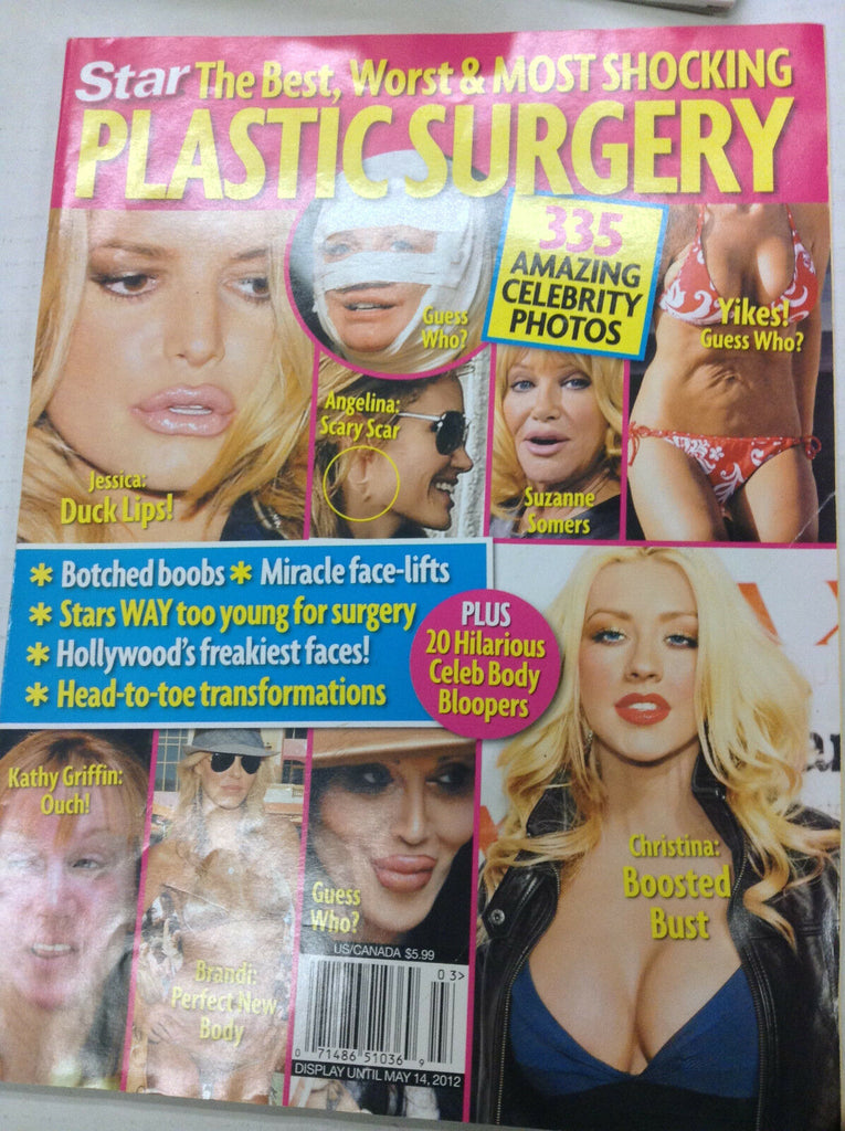 Star Magazine Plastic Surgery Stories May 14, 2012 071217nonr